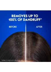 هيد اند شولدرز شامبو ناعم وحريري مضاد للقشرة 1 لتر حزمة من 2