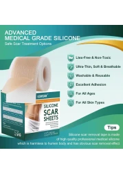 Medical Grade Silicone Scar Sheets Silicone Scar Tape 16x 60 Roll15M Professional Scar Removal Treatment Reusable Silicone Scar Strip for Keloid CSection Surgery Burns Acne Etc