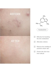 Dr.Althea Azulene 147Ha, Intensive Soothing Cream