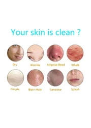 2-Pack Turmeric &amp; Ginger Soap Bars Organic Face Cleansing Anti-Acne Soap, Dark Spot Remover Pimple &amp; Blemish Treatment for All Skin Types