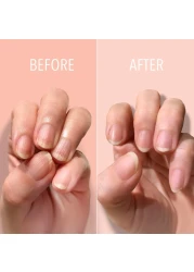 LONDONTOWN Kur Nail Ridge Filler Smoother Strengthener Nail Filler for Damaged Nails Fortifying Self Leveling Base Vegan Cruelty Free Paraben Free Clear 04 fl oz