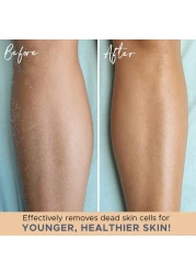 Exfoliating Glove 4 Pcs 2 Pairs Heavy Exfoliate Glove for Dead Skin Bath Exfoliating Gloves for Shower Spa Massage Body Scrub Shower Gloves Exfoliating for Women Men