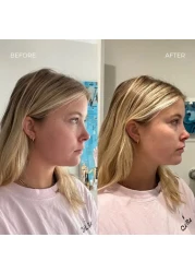 Slimming Face and Neck V-Line Lifting Mask &ndash; Firming Double Chin Up Lift Mask for Neck &amp; Jawline &ndash; Tightening and Sculpting Treatment for a Slimmer Face (1pcs)
