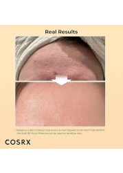 COSRX Advance Snail 96 Mucin Power Essence 100ml
