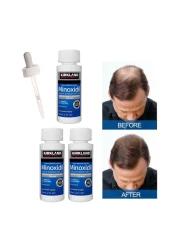 Pack Of 3 Minoxidil 5% Extra Strength Hair Regrowth Bottles 60ml