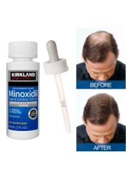 Minoxidil Extra Strength Hair Regrowth Treatment 60ml