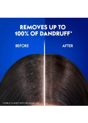 Head &amp; Shoulders Charcoal Detox Anti-Dandruff Shampoo 600ml