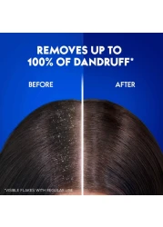 Head &amp; Shoulders Menthol Refresh Anti-Dandruff Shampoo White 400ml+200ml