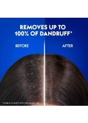 Head &amp; Shoulders Anti-Dandruff Shampoo And Conditioner 2-In-1 Classic Clean White 900ml