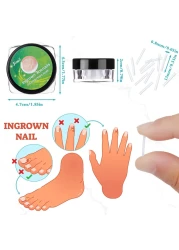 Lanties 152 Pieces Ingrown Toenail Corrector Treatment Tool Sets Include Curved Toenail Brace Nail Toenail Corrector Sticker Ingrown Toenail Corrector Strips Toenail File and Lifter