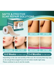 Medical Grade Silicone Scar Sheets Silicone Scar Tape 16x 60 Roll15M Professional Scar Removal Treatment Reusable Silicone Scar Strip for Keloid CSection Surgery Burns Acne Etc