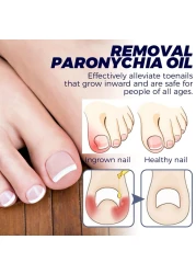 6PCs German Toenailcare Removal Paronychia Oil, Ingrown Toenail Nail Repair, German Toenailplus Oil Nail Renewal Liquid