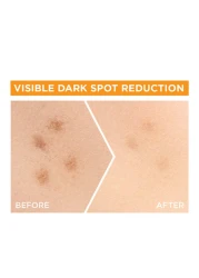 غارنييه سكين أكتيف سيروم فائق للاشراقة السريعة ضد البقع ب X30 فيتامين سي*و نياسيناميد. *vs كريم للاشراقة السريعة للنهار