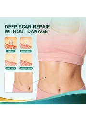 Medical Grade Silicone Scar Sheets Silicone Scar Tape 16x 60 Roll15M Professional Scar Removal Treatment Reusable Silicone Scar Strip for Keloid CSection Surgery Burns Acne Etc