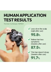 AMOS PROFESSIONALThe Green Tea Shampoo Refresh For Oily Scalp 176oz 500g AntiHair Loss Korean Hair Growth Shampoo for Cleanse Excess Sebum