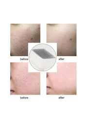 Adjustable Micro Needle derma Stamp Roller 140 Needle 0.5mm-3mm