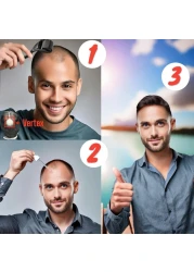 6 Pack Kirkland Minoxidil for Men Hair Regrowth Treatment Liquid Extra Strength 5 Topical Solution 6 Months Supply Dropper Applicator and Microneedle Roller Included Minoxidil Kirkland