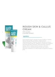 فوتنيس كريم لإزالة الجلد الخشن و مسمار القدم - أبيض 30 ملل
