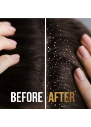 Pantene Pro-V Anti-Dandruff 2-In-1 Shampoo White 200ml